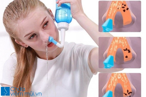 Rửa mũi bằng dung dịch nước muối giúp cải thiện viêm mũi dị ứng