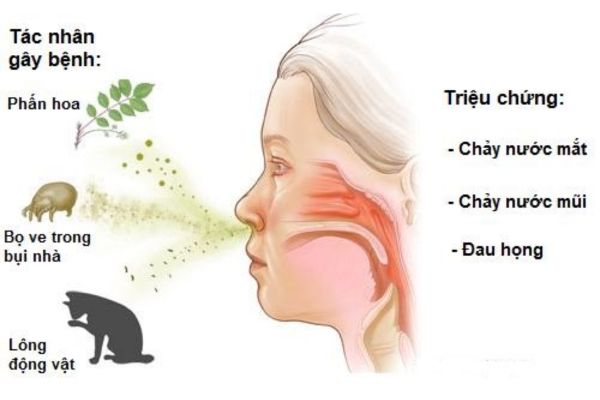 Bệnh viêm mũi dị ứng gây ảnh hưởng như thế nào