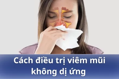 Cách điều trị viêm mũi không dị ứng nào hiệu quả nhất?