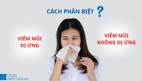 Phân biệt viêm mũi dị ứng và viêm mũi không dị ứng