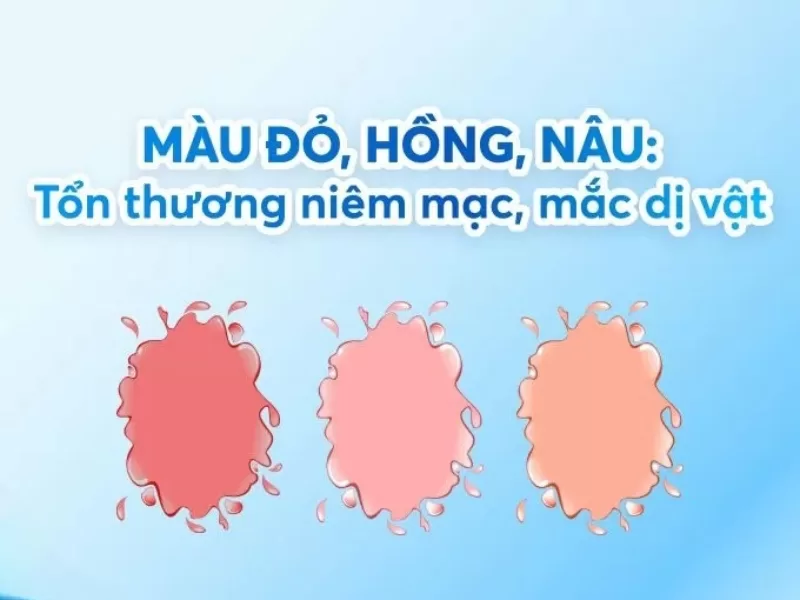 Giải mã bệnh hô hấp qua màu sắc nước mũi