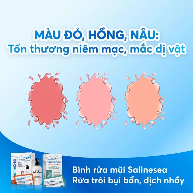 Giải mã bệnh hô hấp qua màu sắc nước mũi