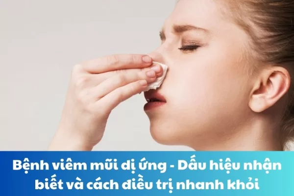 Bệnh viêm mũi dị ứng: Dấu hiệu nhận biết và cách điều trị nhanh khỏi