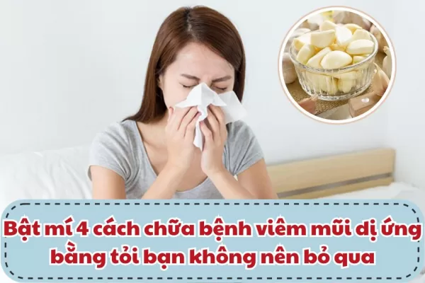 Cách chữa bệnh viêm mũi dị ứng bằng tỏi ngay tại nhà