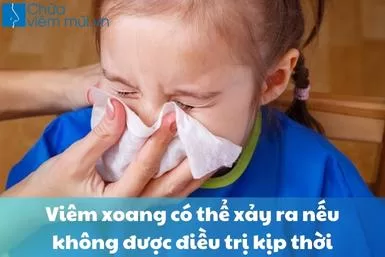 ​ Viêm xoang có thể xảy ra nếu không được điều trị kịp thời