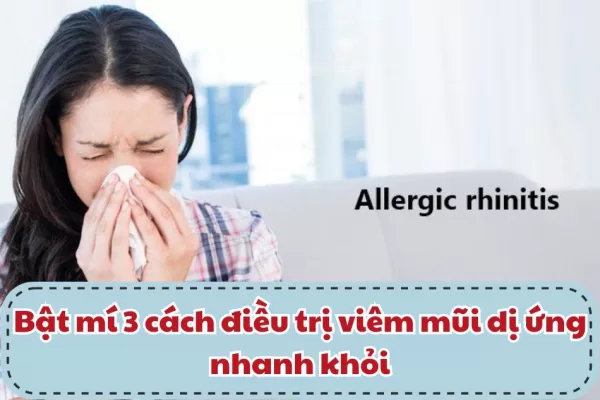 Cách điều trị bệnh viêm mũi dị ứng