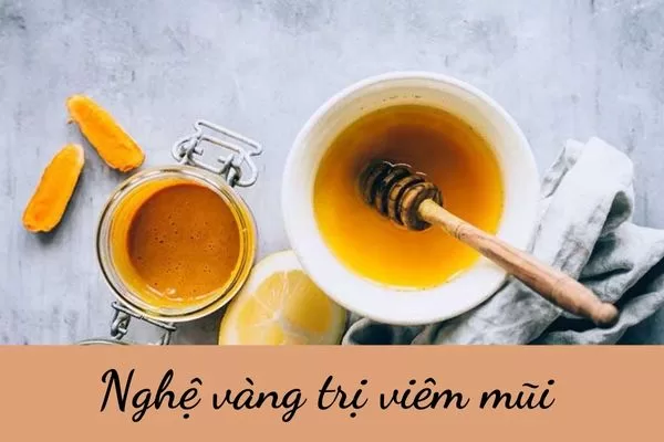 Mẹo trị viêm mũi tại nhà bằng nghệ vàng