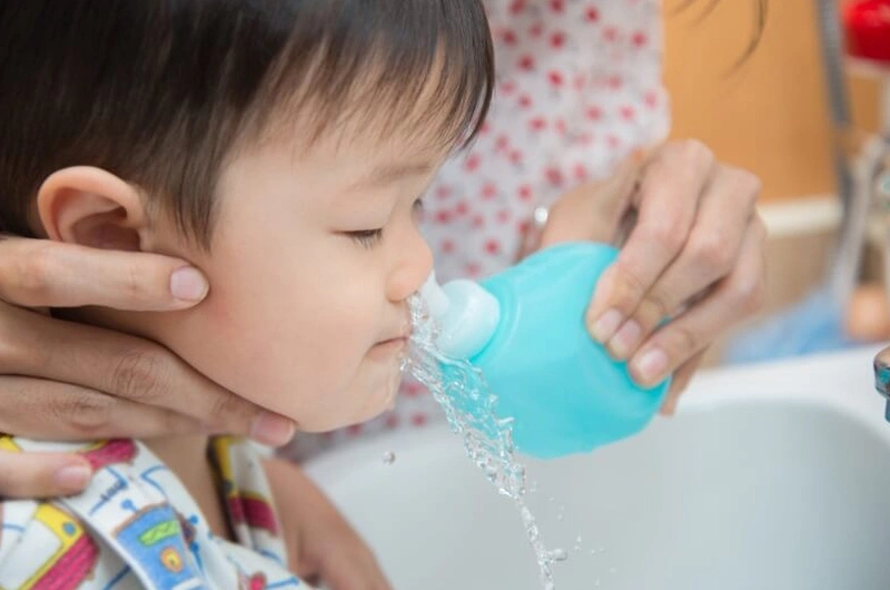 Biến chứng viêm tai giữa khi rửa mũi sai cách. Học ngay cách rửa mũi đúng! Cần lựa chọn dụng cụ vệ sinh mũi cho trẻ phù hợp