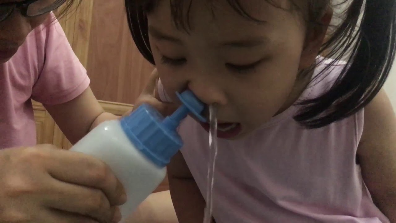 Biến chứng viêm tai giữa khi rửa mũi sai cách. Học ngay cách rửa mũi đúng! Thao tác rửa chính xác sẽ hạn chế tình trạng gây viêm tai rữa ở trẻ