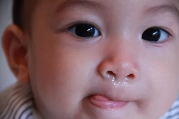 Trẻ bị viêm mũi dị ứng kéo dài: Nguyên nhân và cách khắc phục