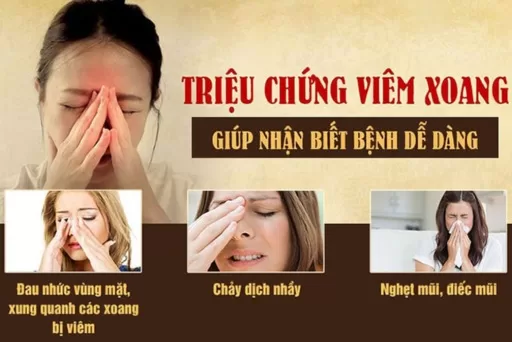 ​ Dấu hiệu nhận biết bệnh viêm xoang