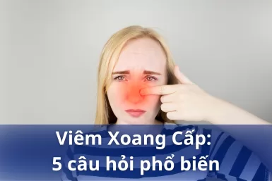 Viêm xoang cấp: 5 câu hỏi phổ biến người mắc bệnh muốn biết câu trả lời nhất