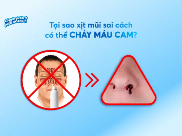 Tại sao xịt mũi sai cách có thể khiến con chảy máu cam?