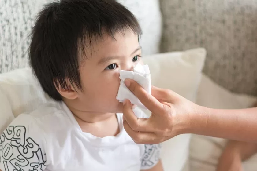 Cách làm giảm sổ mũi tại nhà hiệu quả và an toàn Viêm đường hô hấp trên là nguyên nhân chính gây sổ mũi