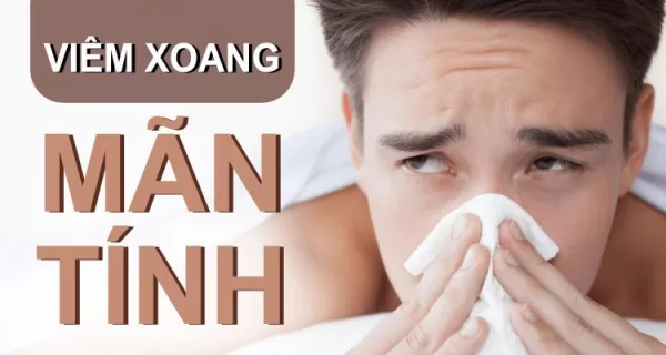 Viêm xoang mạn tinh thường có triệu chứng dai dẳng, không rầm rộ