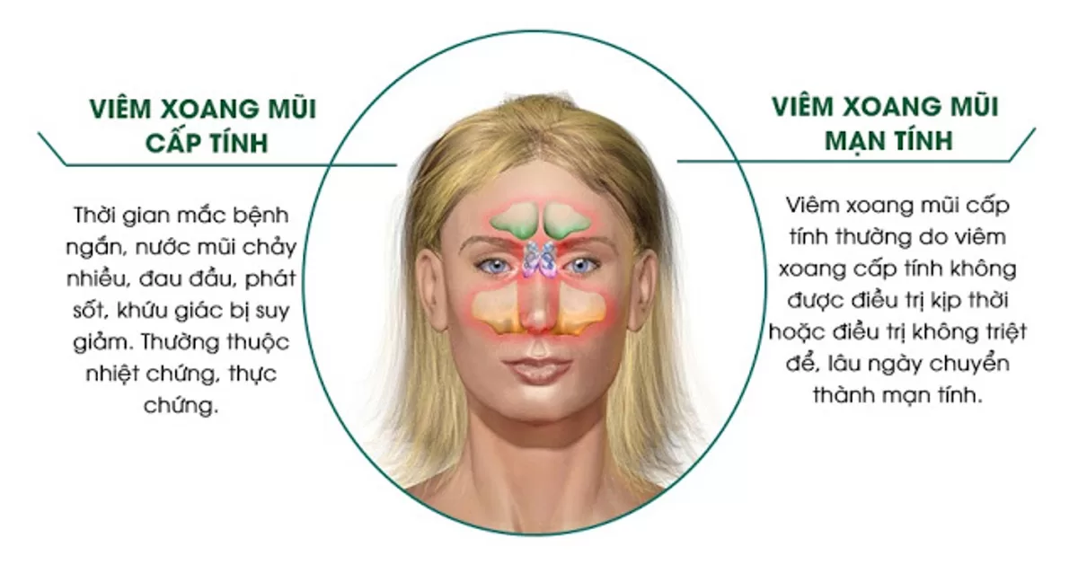 Điều trị viêm xoang mũi tại nhà hiệu quả đừng bỏ qua! Viêm xoang thường được chia thành 2 loại tuỳ theo mức độ và thời gian của bệnh