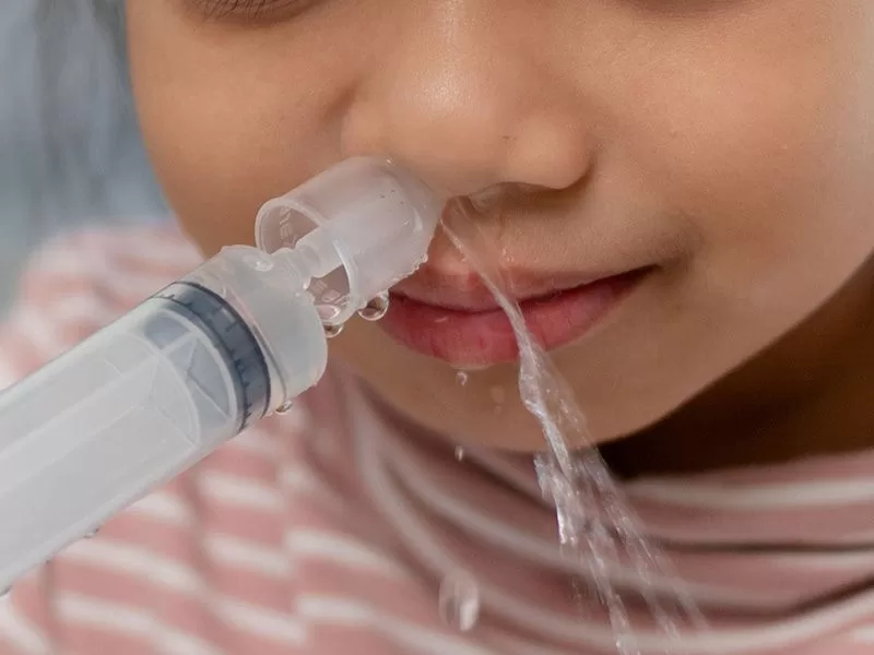 Cách trị viêm mũi tại nhà hiệu quả, an toàn và dễ thực hiện Rửa mũi bằng nước muối sinh lý