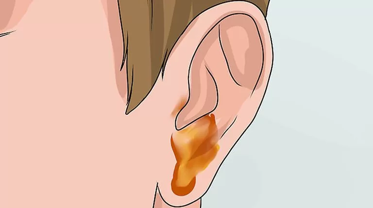 Viêm mũi mãn tính có nguy hiểm không? Giải đáp nhanh gọn! Viêm mũi mãn tính có nguy hiểm không? Giải đáp nhanh gọn!