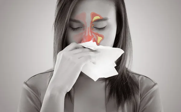 Đề kháng yếu có thể là nguyên nhân gây ra viêm xoang