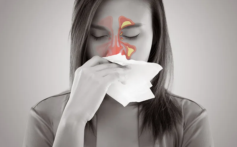 Hiểu rõ nguyên nhân của bệnh viêm xoang cấp để điều trị dứt điểm, tránh tái phát Đề kháng yếu có thể là nguyên nhân gây ra viêm xoang