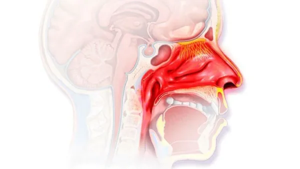 Cách giảm phù nề mũi hiệu quả: Hướng dẫn xử lý đúng nguyên nhân để mũi thông thoáng nhanh