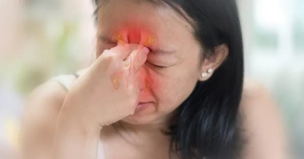 Đau nhức xoang có thể là dấu hiệu cho thấy viêm mũi bội nhiễm
